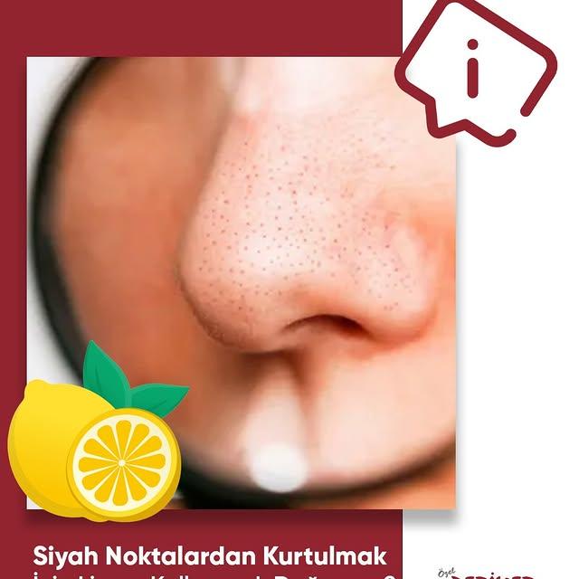 Siyah Noktalardan Kurtulmak İçin Limon Kullanımının Yanlışlıkları